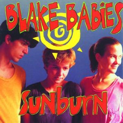 Sunburn